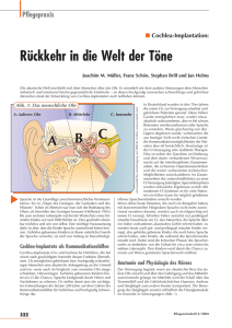 Cochlea-Implantation: Rückkehr in die Welt der Töne