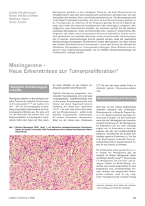 Meningeome - Neue Erkenntnisse zur Tumorproliferation*