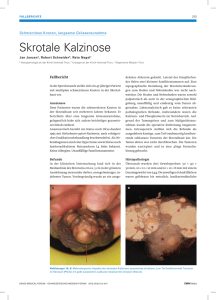 Skrotale Kalzinose - Swiss Medical Forum
