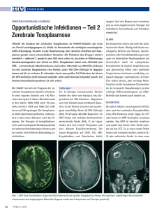Opportunistische Infektionen – Teil 2 Zerebrale Toxoplasmose