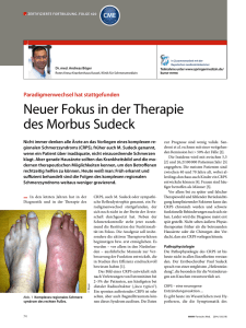 Neuer Fokus in der Therapie des Morbus Sudeck
