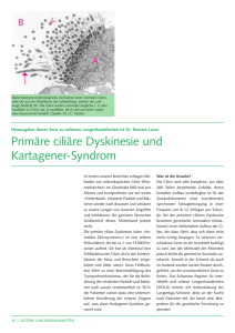 Primäre ciliäre Dyskinesie und Kartagener-Syndrom