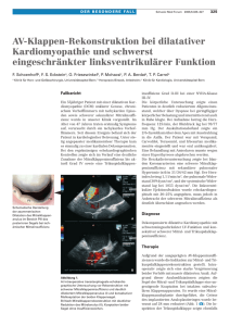AV-Klappen-Rekonstruktion bei dilatativer Kardiomyopathie und