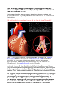 Beim Herzinfarkt verschliesst ein Blutgerinnsel (Thrombus) ein