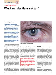 „Rotes Auge“ Was kann der Hausarzt tun?