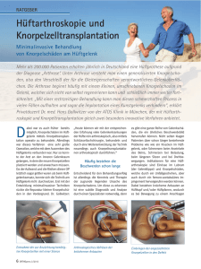 Knorpelzelltransplantation-ACT