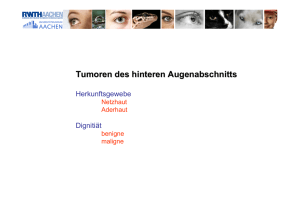 Tumoren des hinteren Augenabschnitts - Eyenet