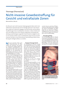 Nicht-invasive Gewebestraffung für Gesicht und extrafaziale Zonen