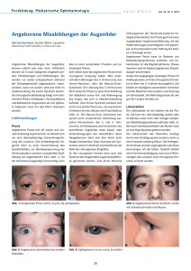Angeborene Missbildungen der Augenlider