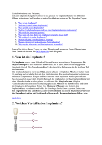 Information zu Implantaten - Mund-Kiefer