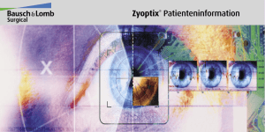 Zyoptix - Augen.de