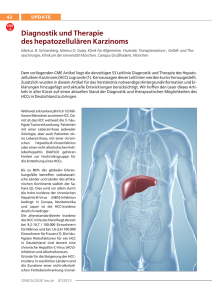Diagnostik und Therapie des hepatozellulären Karzinoms