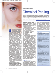 Chemical Peeling