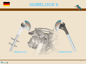 HUMELOCK II
