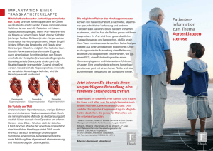 Patienten- information zum Thema Aortenklappen- stenose