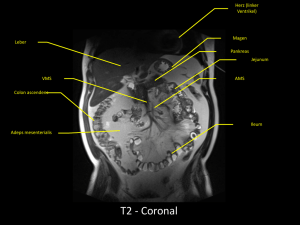 T2 - Coronal - radiologie-uni
