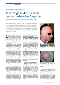 Lichen planopilaris - Dermatologische Praxis und Haarcenter