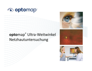 optomap – Präsentation für Patienten