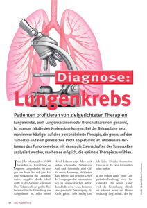 Diagnose - Lungenkrebs Testen