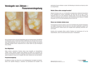 Versiegeln von Zähnen – Fissurenversiegelung - zahnarzt