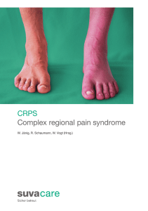 CRPS Complex regional pain syndrome