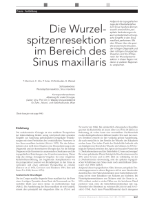 Die Wurzelspitzenresektion im Bereich des Sinus maxillaris