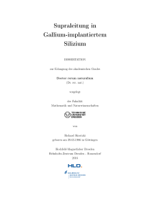 Supraleitung in Gallium-implantiertem Silizium