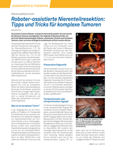 Tipps und Tricks für komplexe Tumoren