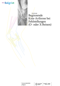 Beginnende Knie-Arthrose bei Fehlstellungen (O- oder X