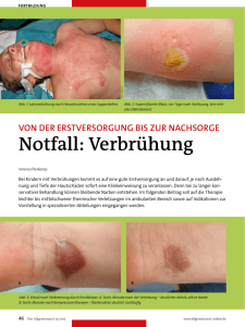 Notfall: Verbrühung