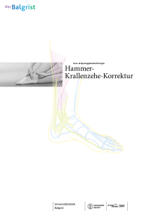 Hammer- Krallenzehe-Korrektur