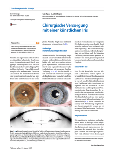 Chirurgische Versorgung mit einer künstlichen Iris