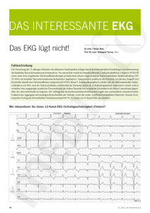 Das EKG lügt nicht! - Aerzteverlag medinfo AG