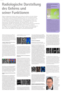 Radiologische Darstellung des Gehirns und seiner Funktionen
