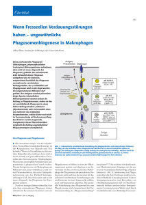 Wenn Fresszellen Verdauungsstörungen haben