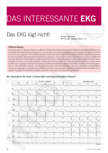 Das EKG lügt nicht!