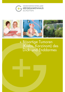 + Bösartige Tumoren (Krebs, Karzinom) des Dick
