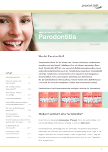 Parodontitis - praxisklinik.net