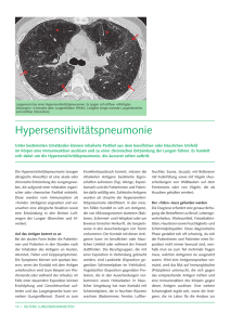 Hypersensitivitätspneumonie