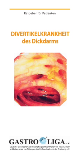 Divertikulose und Divertikulitis (Divertikelkrankheit) Krankheiten des