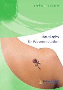 Hautkrebs - Krebsgesellschaft NRW