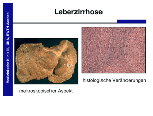 Leberzirrhose - Uniklinik RWTH Aachen