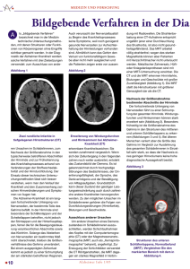 Bildgebende Verfahren in der Diagnostik der Alzheimer