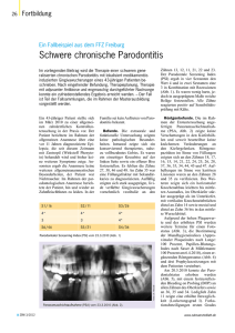 Schwere chronische Parodontitis