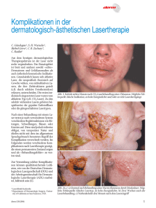 Komplikationen in der dermatologisch