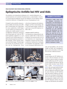 Epileptische Anfälle bei HIV und Aids