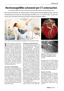 Herzkranzgefäße schonend per CT untersuchen