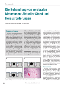 Die Behandlung von zerebralen Metastasen: Aktueller Stand und