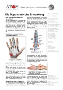 Die Dupuytren`sche Erkrankung