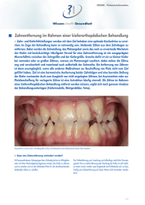 Zahnentfernung im Rahmen einer kieferorthopädischen